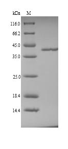(Tris-Glycine gel) Discontinuous SDS-PAGE (reduced) with 5% enrichment gel and 15% separation gel.